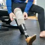Amputation Injury Lawyer