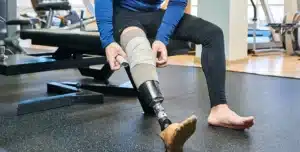 Amputation Injury Lawyer